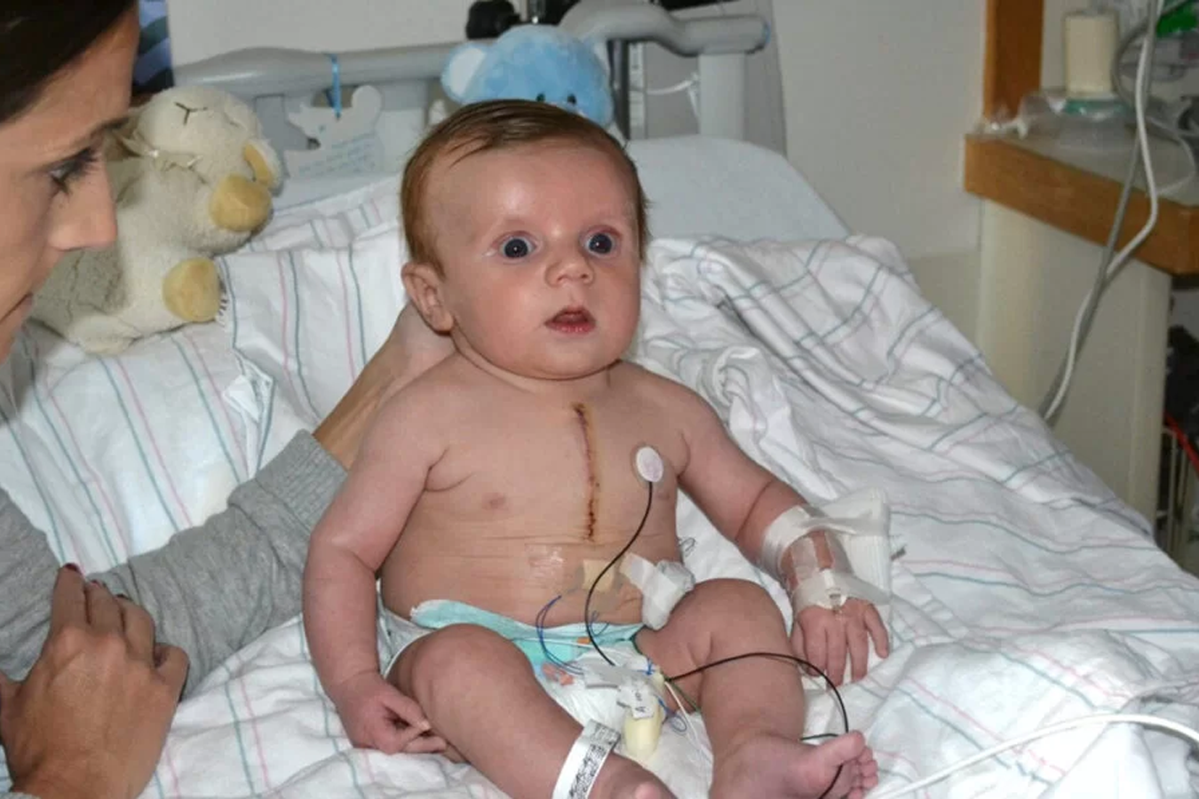 Pediatric Cardiac Surgery